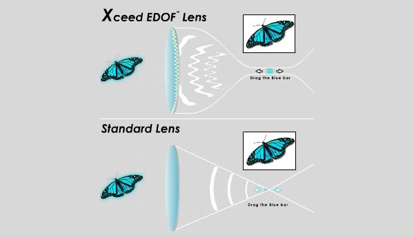 Вместо одного фокального пятна получается целый канал. (Иллюстрация Xceed Imaging.)
